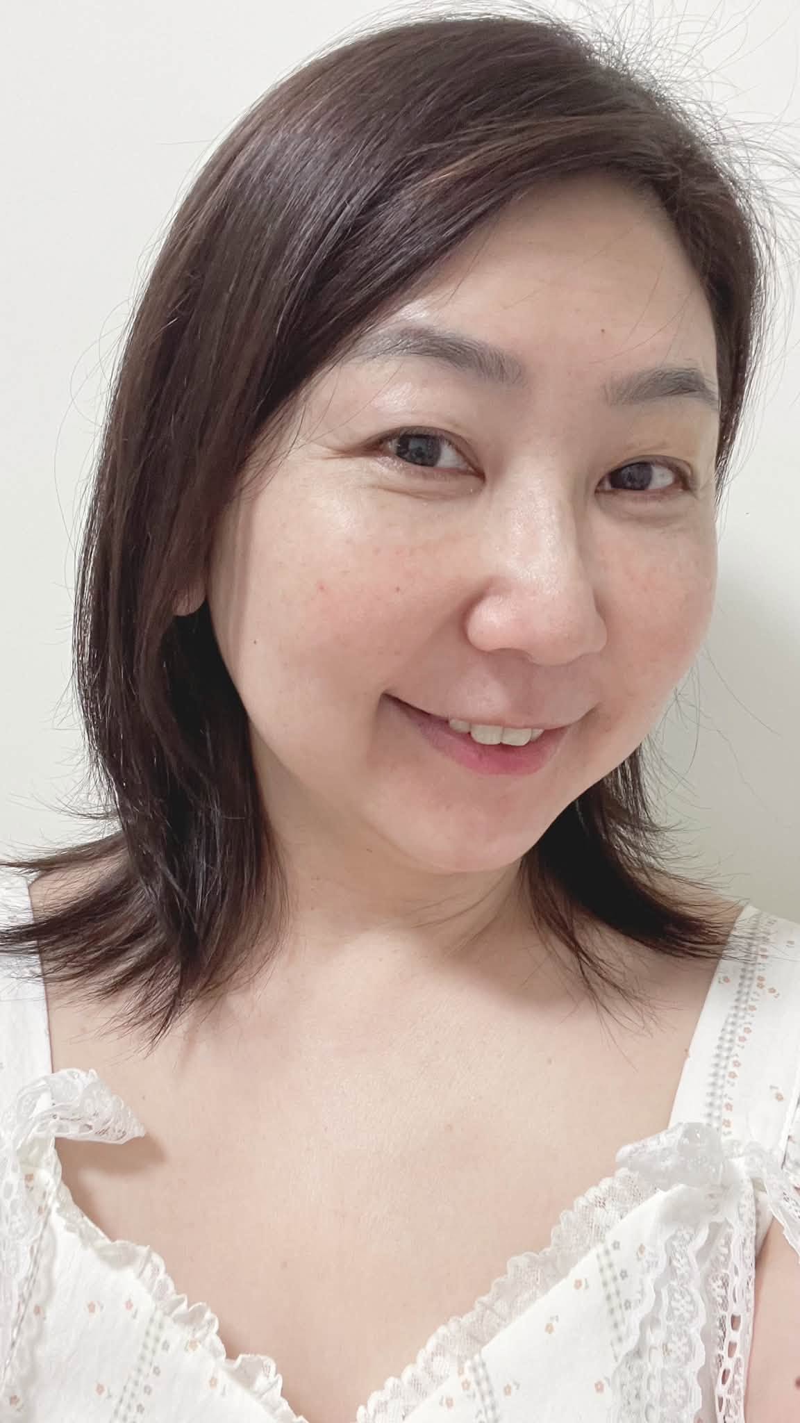 關於眼袋手術的個人紀錄:一段關於選擇、修復與生活好氣色的紀錄 @蜜絲米的散步生活 @蜜絲米的散步生活
