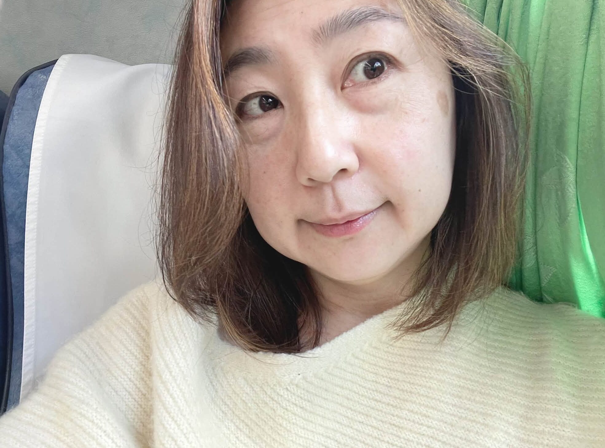 關於眼袋手術的個人紀錄:一段關於選擇、修復與生活好氣色的紀錄 @蜜絲米的散步生活 @蜜絲米的散步生活